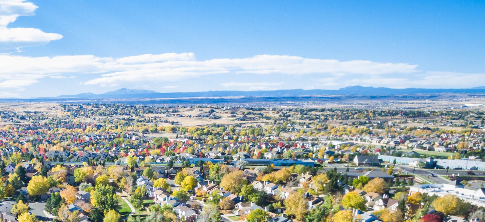 How Much Is Tooth Whitening In Denver?