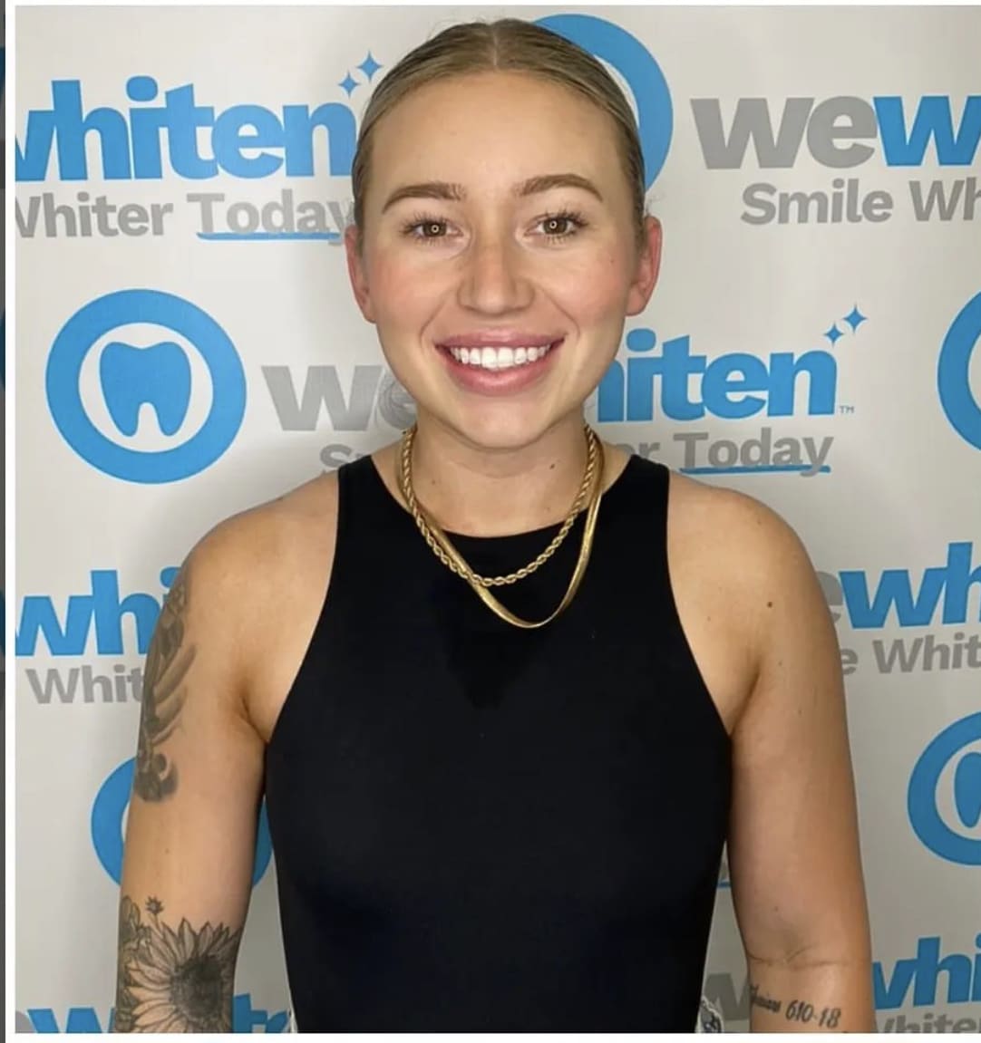 Laser Teeth Whitening in Fort Worth