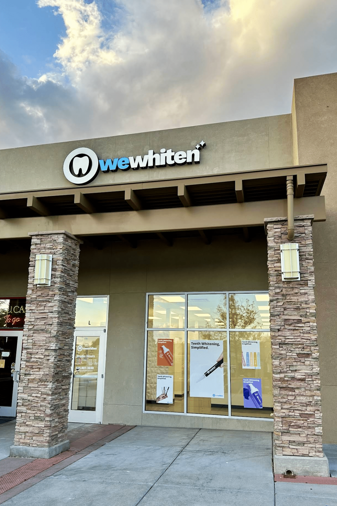 What to Expect From Professional Teeth Whitening in One Visit