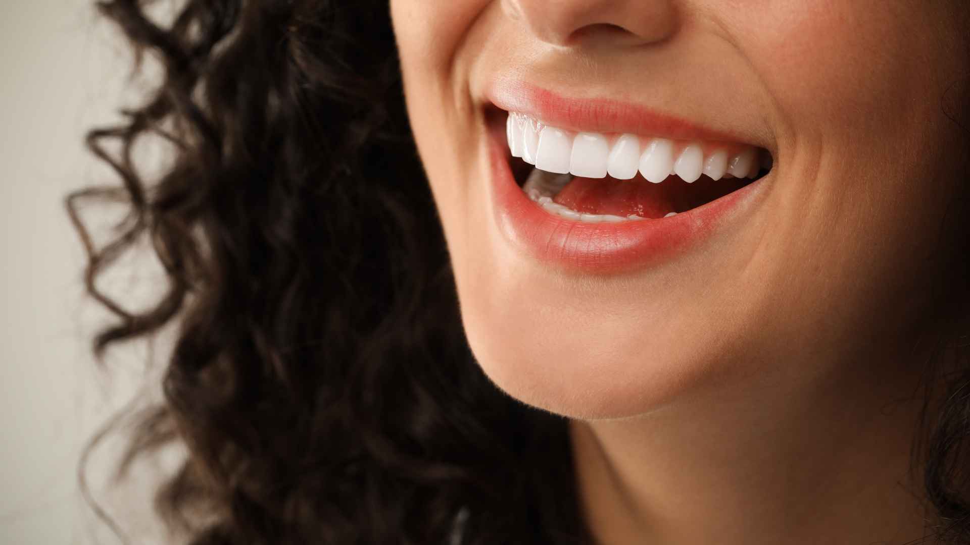 Can You Whiten Crowns, Veneers, Fillings, or Bonding?